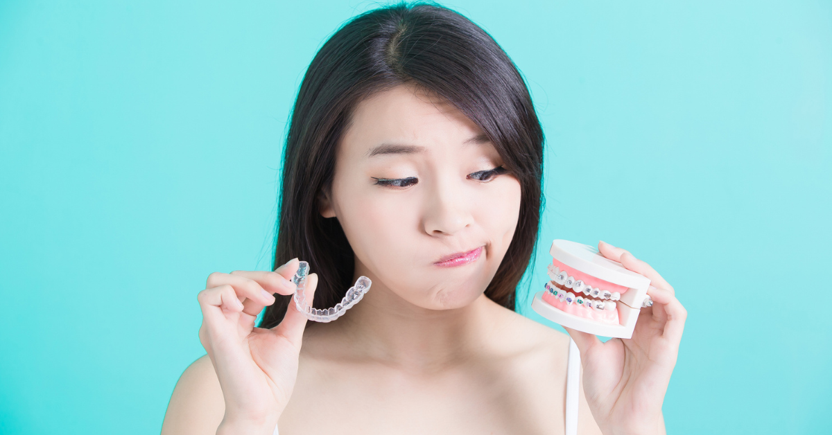 Damon Ultima vs. Invisalign Which Is Right for Your Smile