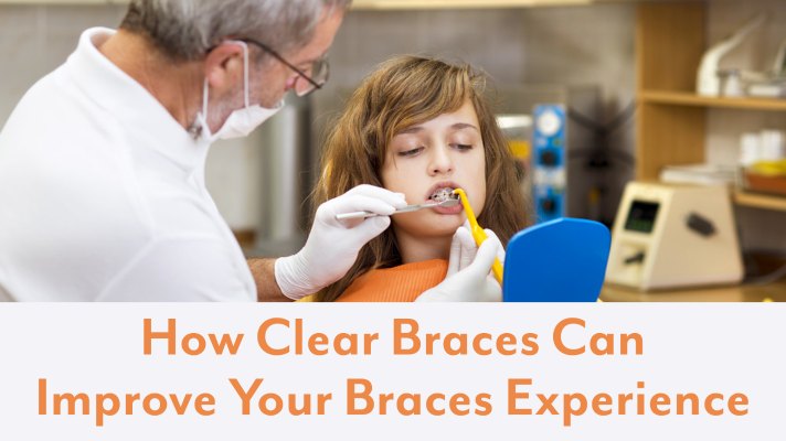 How Clear Braces Can Improve Your Braces Experience