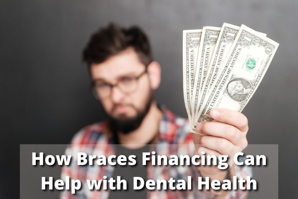braces financing